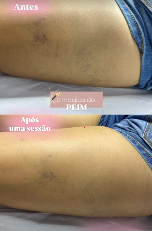 Depoimento de cliente 4